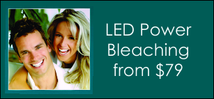 LED Power Teeth  Bleaching Offer